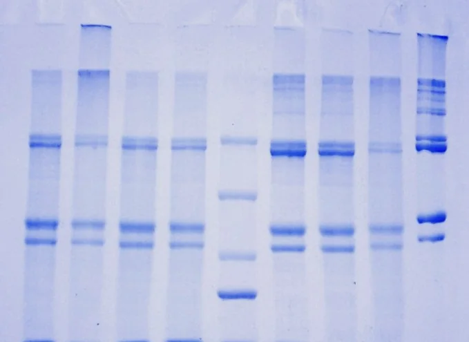 SDS-PAGE gel showing protein bands from LASRA molecular profiling work.